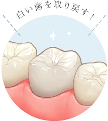 白い歯を取り戻す!